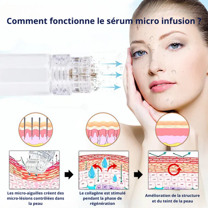 Embouts de Micro-Infusion